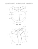 Prosthetic Heart Valves, Scaffolding Structures, and Systems and Methods for Implantation of Same diagram and image