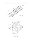 Prosthetic Heart Valves, Scaffolding Structures, and Systems and Methods for Implantation of Same diagram and image