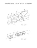 Prosthetic Heart Valves, Scaffolding Structures, and Systems and Methods for Implantation of Same diagram and image