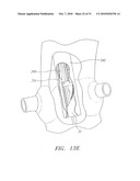 Prosthetic Heart Valves, Scaffolding Structures, and Systems and Methods for Implantation of Same diagram and image