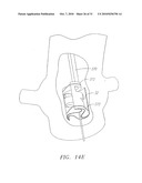 Prosthetic Heart Valves, Scaffolding Structures, and Systems and Methods for Implantation of Same diagram and image