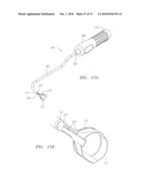 Prosthetic Heart Valves, Scaffolding Structures, and Systems and Methods for Implantation of Same diagram and image