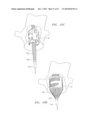 Prosthetic Heart Valves, Scaffolding Structures, and Systems and Methods for Implantation of Same diagram and image