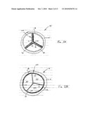 PROSTHETIC HEART VALVES, SUPPORT STRUCTURES AND SYSTEMS AND METHODS FOR IMPLANTING THE SAME, diagram and image