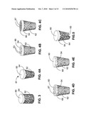 MONOLITHIC ORTHOPEDIC IMPLANT WITH AN ARTICULAR FINISHED SURFACE diagram and image