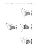 MONOLITHIC ORTHOPEDIC IMPLANT WITH AN ARTICULAR FINISHED SURFACE diagram and image