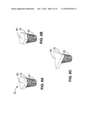 MONOLITHIC ORTHOPEDIC IMPLANT WITH AN ARTICULAR FINISHED SURFACE diagram and image