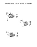 MONOLITHIC ORTHOPEDIC IMPLANT WITH AN ARTICULAR FINISHED SURFACE diagram and image