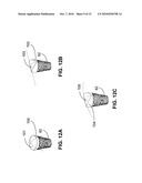 MONOLITHIC ORTHOPEDIC IMPLANT WITH AN ARTICULAR FINISHED SURFACE diagram and image