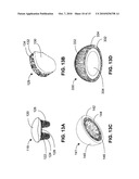 MONOLITHIC ORTHOPEDIC IMPLANT WITH AN ARTICULAR FINISHED SURFACE diagram and image