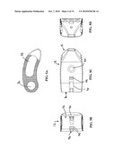 Method of Installation of Intervertebral Spacers diagram and image