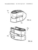 Method of Installation of Intervertebral Spacers diagram and image