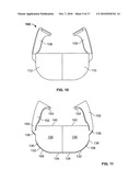 MINIMALLY INVASIVE TOTAL SPINE IMPLANT diagram and image