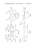 MINIMALLY INVASIVE TOTAL SPINE IMPLANT diagram and image