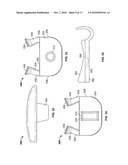 MINIMALLY INVASIVE TOTAL SPINE IMPLANT diagram and image