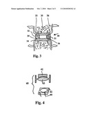 Modular Prostheses and Method for the Implantation of Modular Prostheses diagram and image