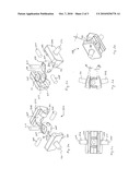 ARTIFICIAL JOINT diagram and image