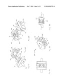 ARTIFICIAL JOINT diagram and image