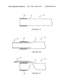 Eversion Resistant Sleeves diagram and image