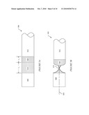 Eversion Resistant Sleeves diagram and image