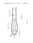 Eversion Resistant Sleeves diagram and image