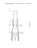 Eversion Resistant Sleeves diagram and image