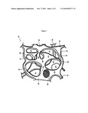 At least partially resorbable reticulated elastomeric matrix elements and methods of making same diagram and image