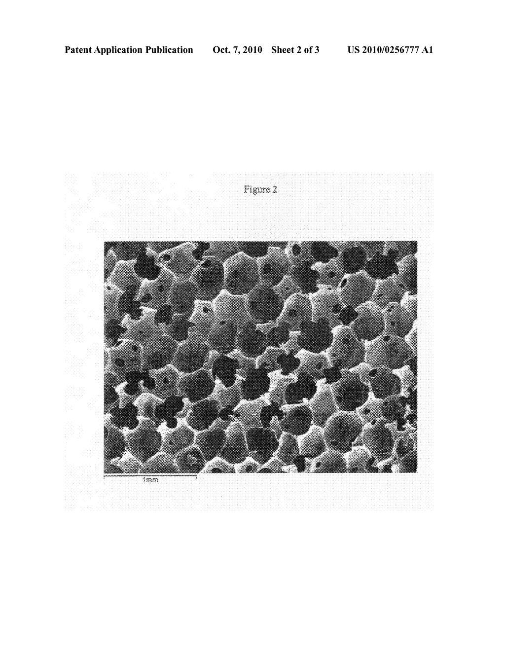 At least partially resorbable reticulated elastomeric matrix elements and methods of making same - diagram, schematic, and image 03