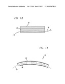 Surgical Implant diagram and image