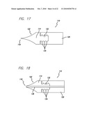 Surgical Implant diagram and image