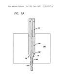 Surgical Implant diagram and image