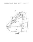 VENTILATING SPACING STRIP BETWEEN REAR SURFACE OF SIDING AND OUTER SURFACE OF STRUCTURE ALLOWING HORIZONTAL AIR CIRCULATION diagram and image