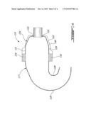 REVERSE FLOW CERAMIC MATRIX COMPOSITE COMBUSTOR diagram and image