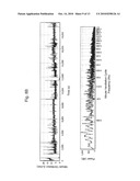 METHODS AND APPARATUS FOR HEART FAILURE TREATMENT diagram and image