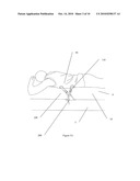 DEVICE AND METHOD FOR PREVENTING OR REDUCING SNORING AND/OR SLEEP APNEA diagram and image