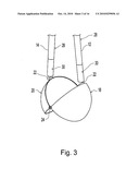 Post Hole Digger diagram and image