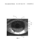 Ocular surface interferometry (OSI) methods for imaging, processing, and/or displaying an ocular tear film diagram and image