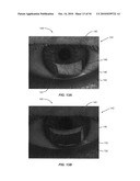 Ocular surface interferometry (OSI) methods for imaging, processing, and/or displaying an ocular tear film diagram and image