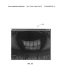 Ocular surface interferometry (OSI) methods for imaging, processing, and/or displaying an ocular tear film diagram and image