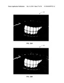 Ocular surface interferometry (OSI) methods for imaging, processing, and/or displaying an ocular tear film diagram and image