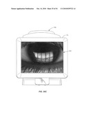 Ocular surface interferometry (OSI) methods for imaging, processing, and/or displaying an ocular tear film diagram and image