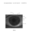 Ocular surface interferometry (OSI) methods for imaging and measuring ocular tear film layer thickness(es) diagram and image