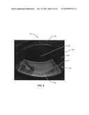 Ocular surface interferometry (OSI) methods for imaging and measuring ocular tear film layer thickness(es) diagram and image