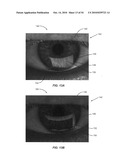 Ocular surface interferometry (OSI) methods for imaging and measuring ocular tear film layer thickness(es) diagram and image