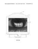 Ocular surface interferometry (OSI) methods for imaging and measuring ocular tear film layer thickness(es) diagram and image