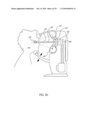 ORTHOVOLTAGE RADIOTHERAPY diagram and image