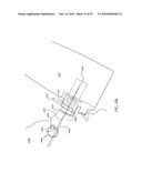 ORTHOVOLTAGE RADIOTHERAPY diagram and image