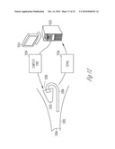 System for estimating sound pressure levels at the tympanic membrane using pressure-minima based distance diagram and image