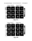 Nanoparticles for brain tumor imaging diagram and image