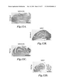 Nanoparticles for brain tumor imaging diagram and image